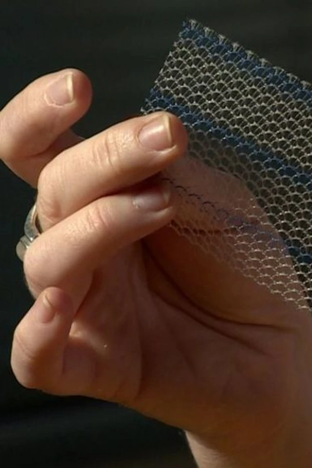 Compensation for surgical mesh errors